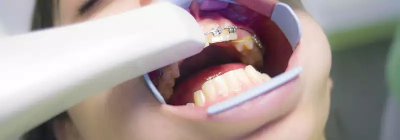 Learndirect - How to Become a Dental Nurse in a Hospital Setting - Orthodontics - Dental photography - Dental nursing - Dental nurse - Dental nursing assistant - NEBDN 