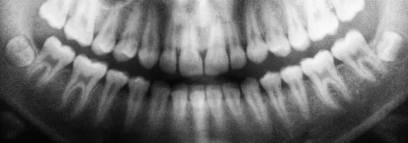 Learndirect - How to Become a Dental Nurse in a Hospital Setting - Radiography - Dental photography - Dental nursing - Dental nurse - Dental nursing assistant - NEBDN 