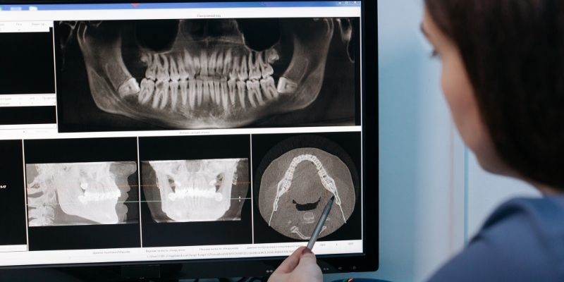 role of a radiographer