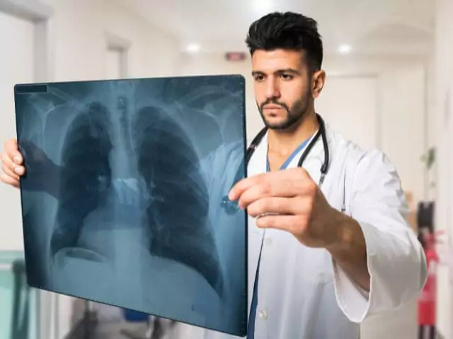 male doctor looking at x-ray